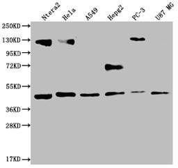 Western Blot. Positive WB detected in: Ntera-2 whole cell lysate, Hela whole cell lysate, A549 whole cell lysate, HepG2 whole cell lysate, PC3 whole cell lysate, U87 whole cell lysate. All lanes: HIF1AN antibody at 1:2000. Secondary. Goat polyclonal to rabbit IgG at 1/50000 dilution. Predicted band size: 41 kDa. Observed band size: 36-53 kDa.