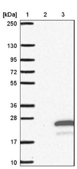 Western Blot: transmembrane protein 138 Antibody [NBP1-92528] - Lane 1: Marker [kDa] 250, 130, 95, 72, 55, 36, 28, 17, 10<br/>Lane 2: Negative control (vector only transfected HEK293T lysate)<br/>Lane 3: Over-expression lysate (Co-expressed with a C-terminal myc-DDK tag (~3.1 kDa) in mammalian HEK293T cells, LY413965)