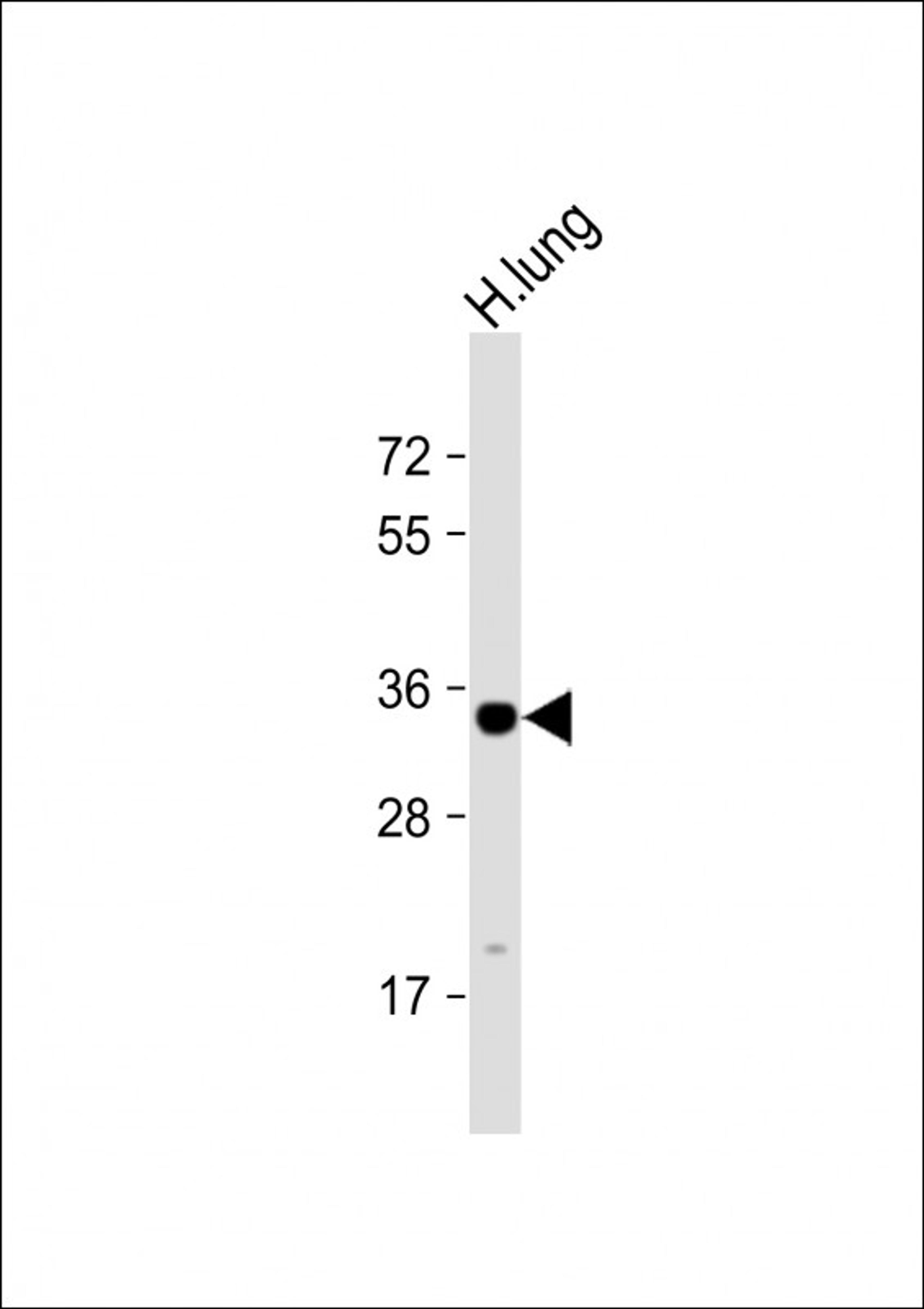 Western Blot at 1:1000 dilution + human lung lysate Lysates/proteins at 20 ug per lane.