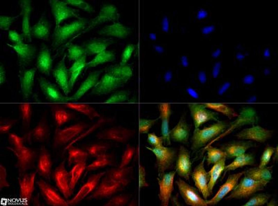 Immunocytochemistry/Immunofluorescence: ACSL1 Antibody [NB110-99585] - ACSL1 antibody was tested in HepG2 cells with DyLight 488 (green). Nuclei and alpha-tubulin were counterstained with DAPI (blue) and Dylight 550 (red).