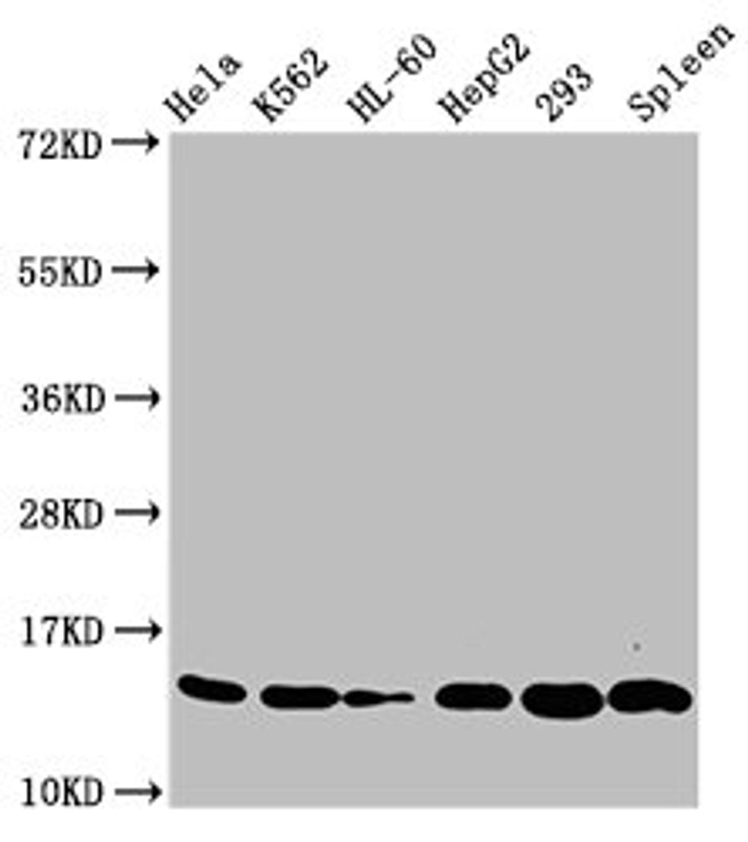 Western Blot. Positive WB detected in: Hela whole cell lysate, K562 whole cell lysate, HL60 whole cell lysate, HepG2 whole cell lysate, 293 whole cell lysate, Rat spleen tissue. All lanes: HIST1H2BC antibody at 0.33µg/ml. Secondary. Goat polyclonal to rabbit IgG at 1/50000 dilution. Predicted band size: 14 kDa. Observed band size: 14 kDa