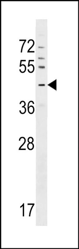 Western blot analysis in CEM cell line lysates (35ug/lane).