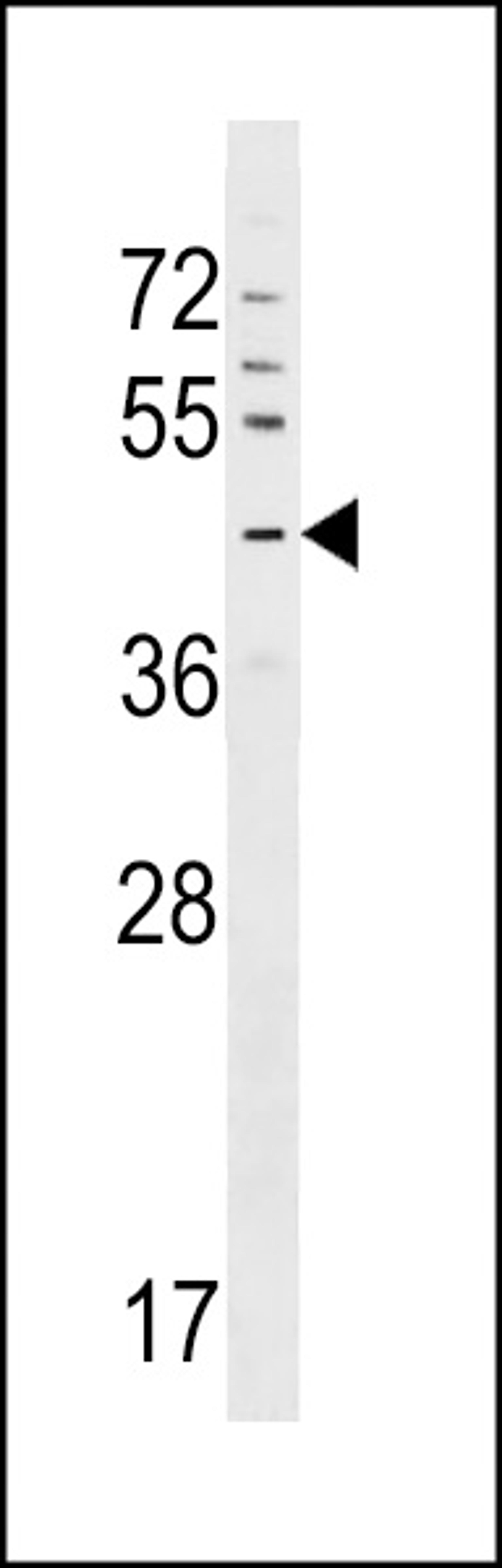 Western blot analysis in CEM cell line lysates (35ug/lane).