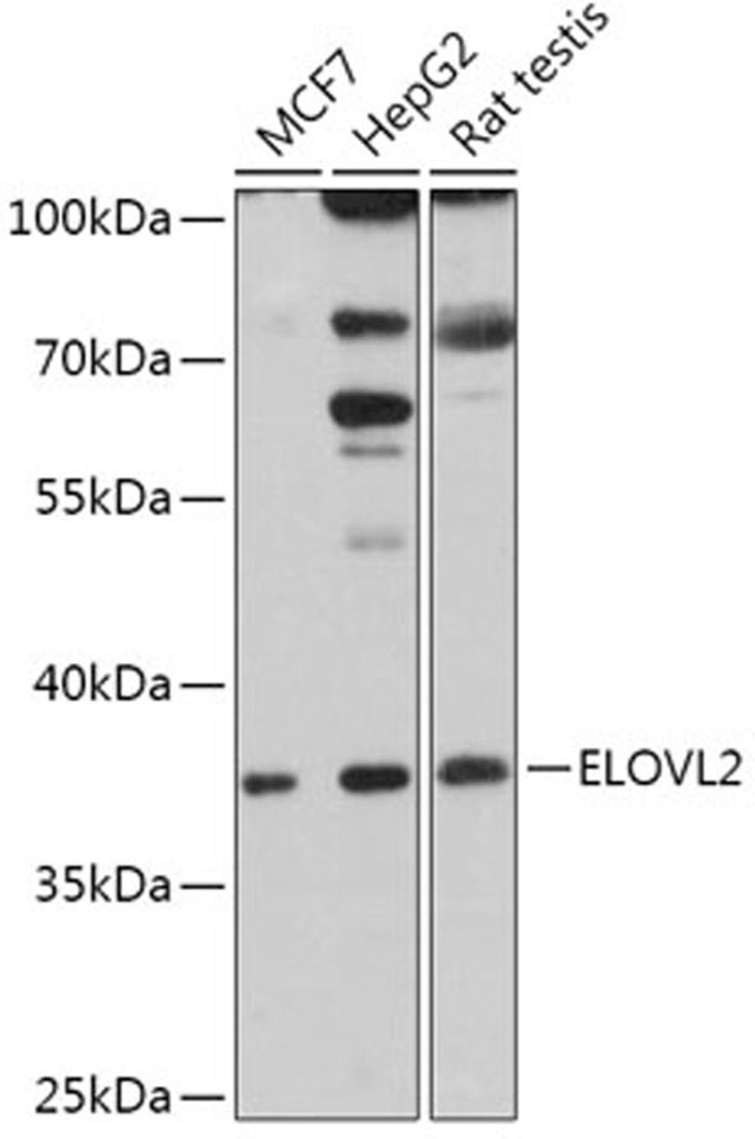 Western blot - ELOVL2 antibody (A17712)