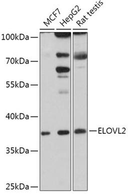 Western blot - ELOVL2 antibody (A17712)