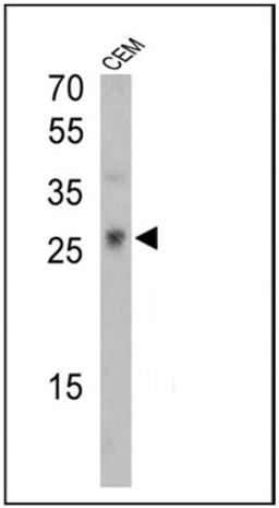 Western Blot: TCR gamma/delta Antibody (7A5) [NBP2-22510] - Analysis of 25 ug of CEM cell lysates.