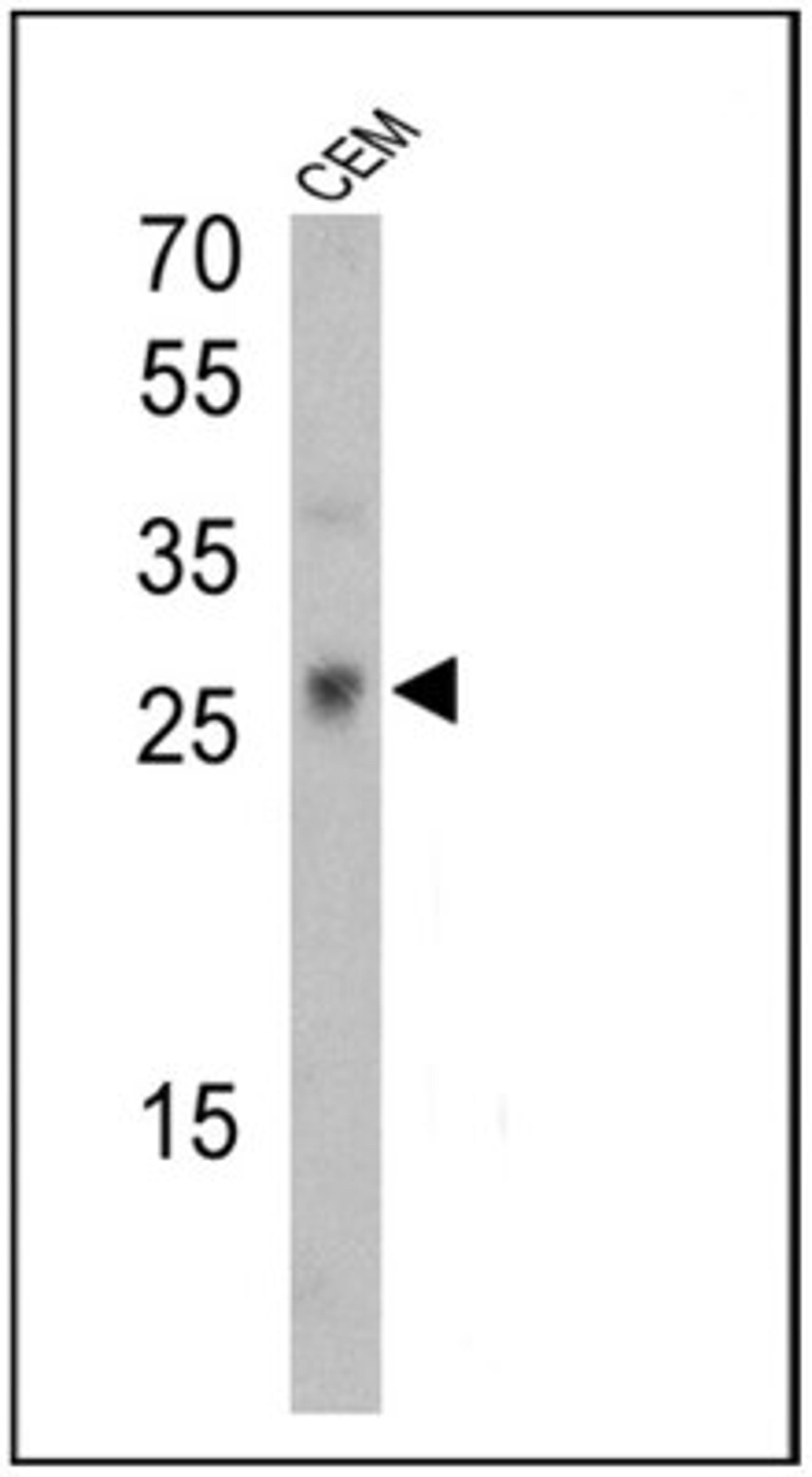 Western Blot: TCR gamma/delta Antibody (7A5) [NBP2-22510] - Analysis of 25 ug of CEM cell lysates.