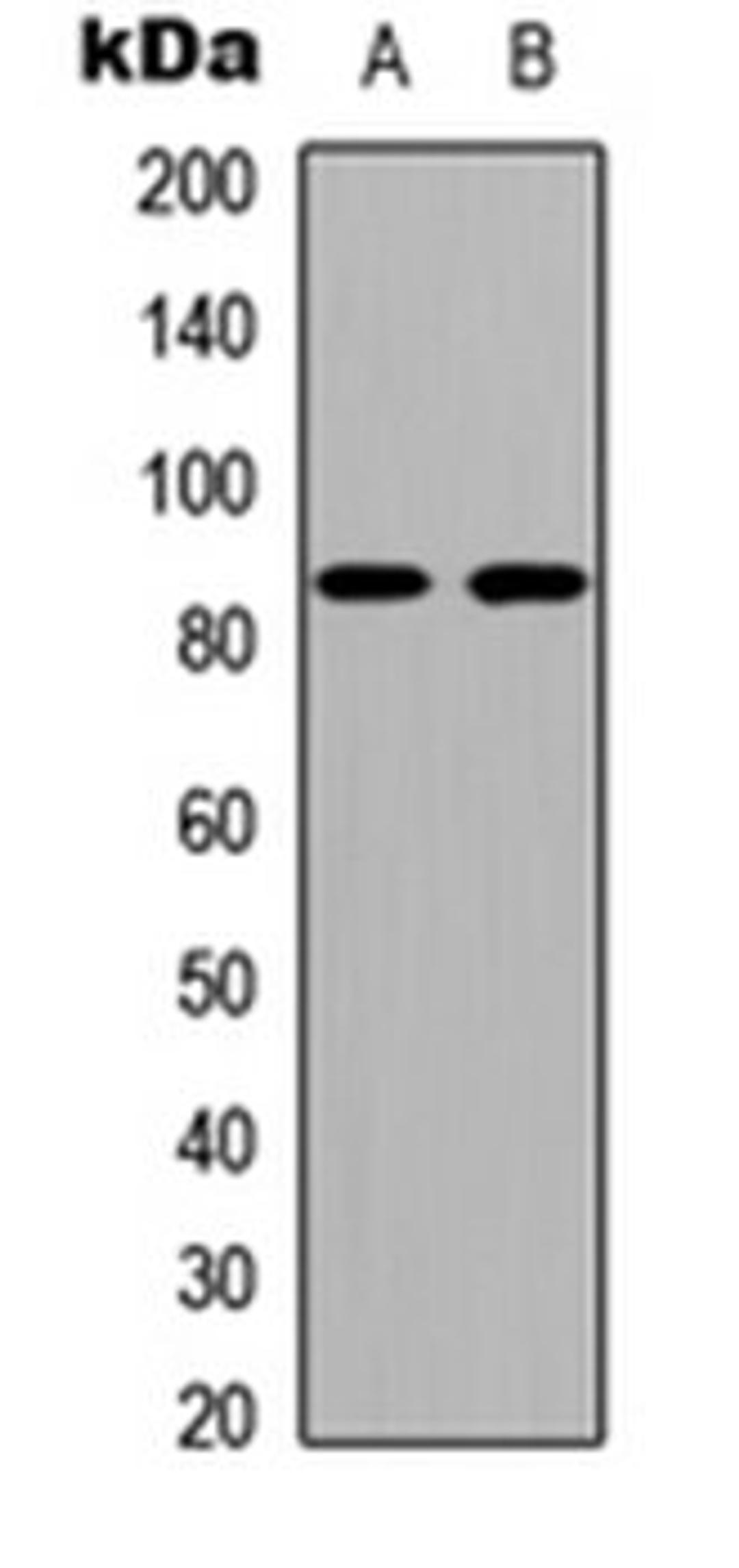 Western blot analysis of COLO205 (Lane 1), NIH3T3 (Lane 2) whole cell lysates using Cadherin 19 antibody