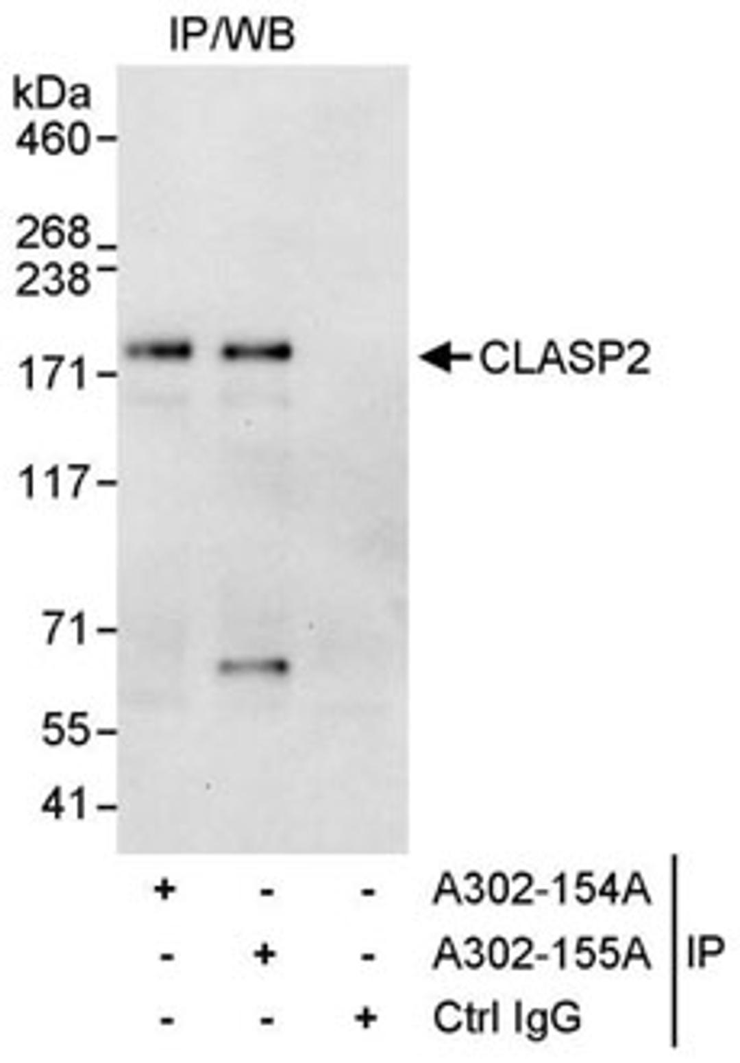 Detection of human CLASP2 by western blot of immunoprecipitates.