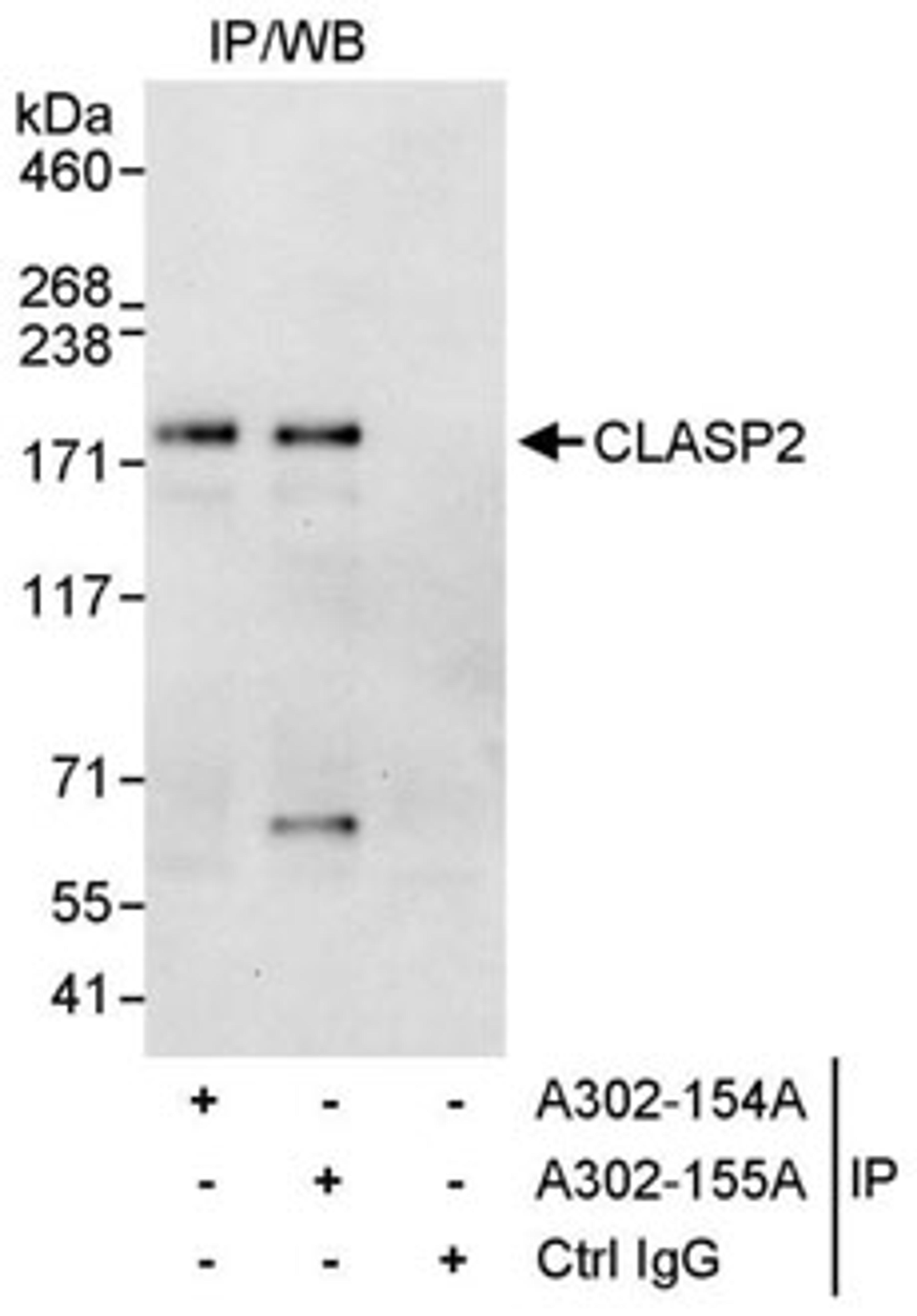 Detection of human CLASP2 by western blot of immunoprecipitates.