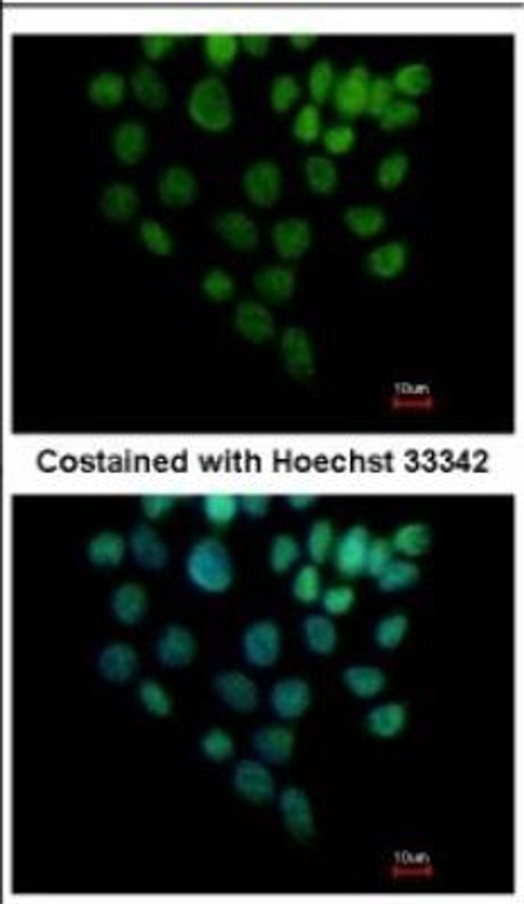 Immunocytochemistry/Immunofluorescence: SIN3B Antibody [NBP2-20367] - Immunofluorescence analysis of paraformaldehyde-fixed HCT116, using antibody at 1:500 dilution.