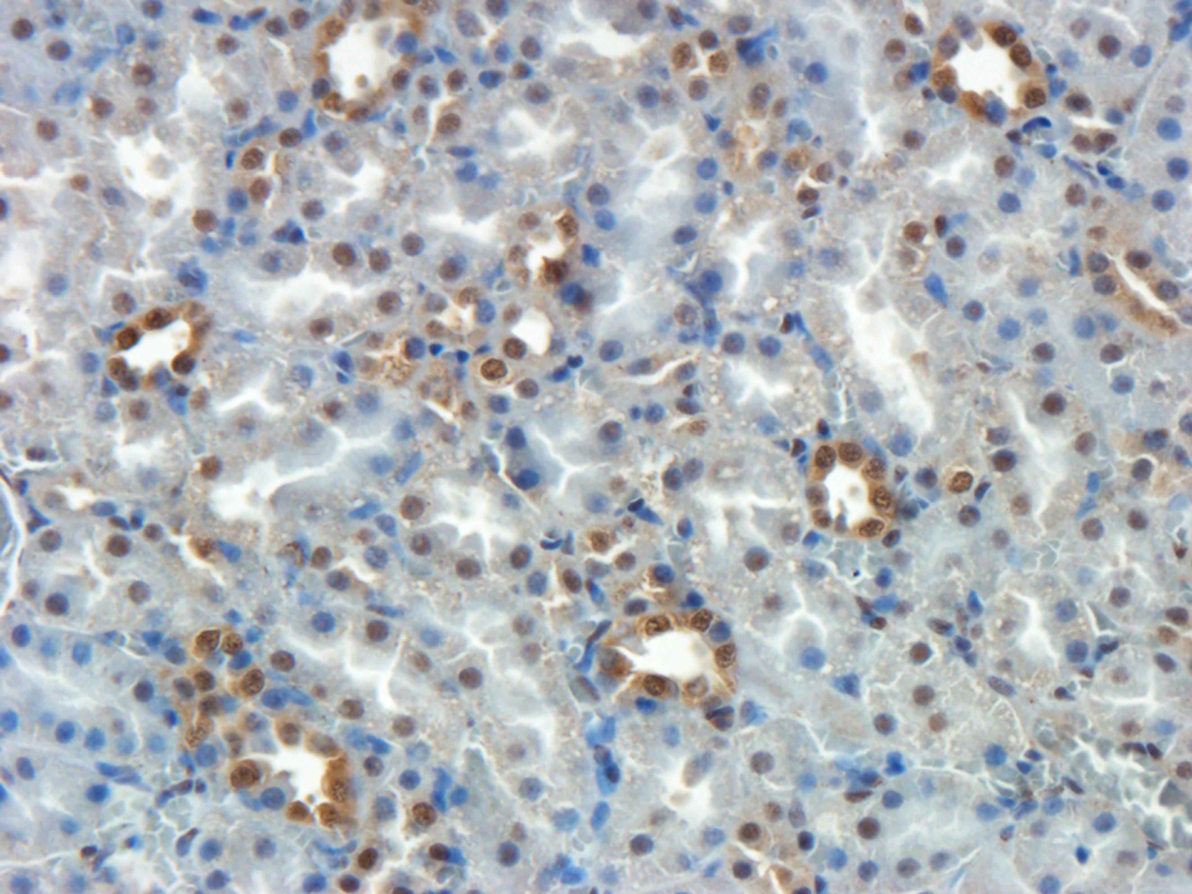 Immunohistochemical staining of paraffin embedded rat kidney tissue using beta 1 Adrenergic Receptor antibody (primary antibody at 1:100)