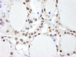 Detection of human CSN2 by immunohistochemistry.