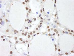 Detection of human CSN2 by immunohistochemistry.