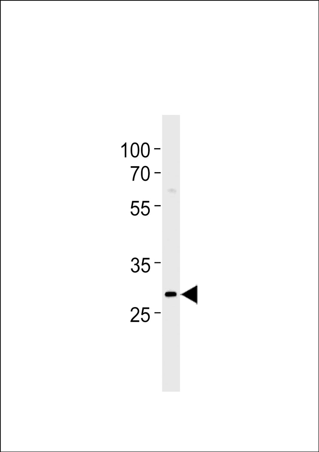 Western blot analysis in Daudi cell line lysates (35ug/lane).