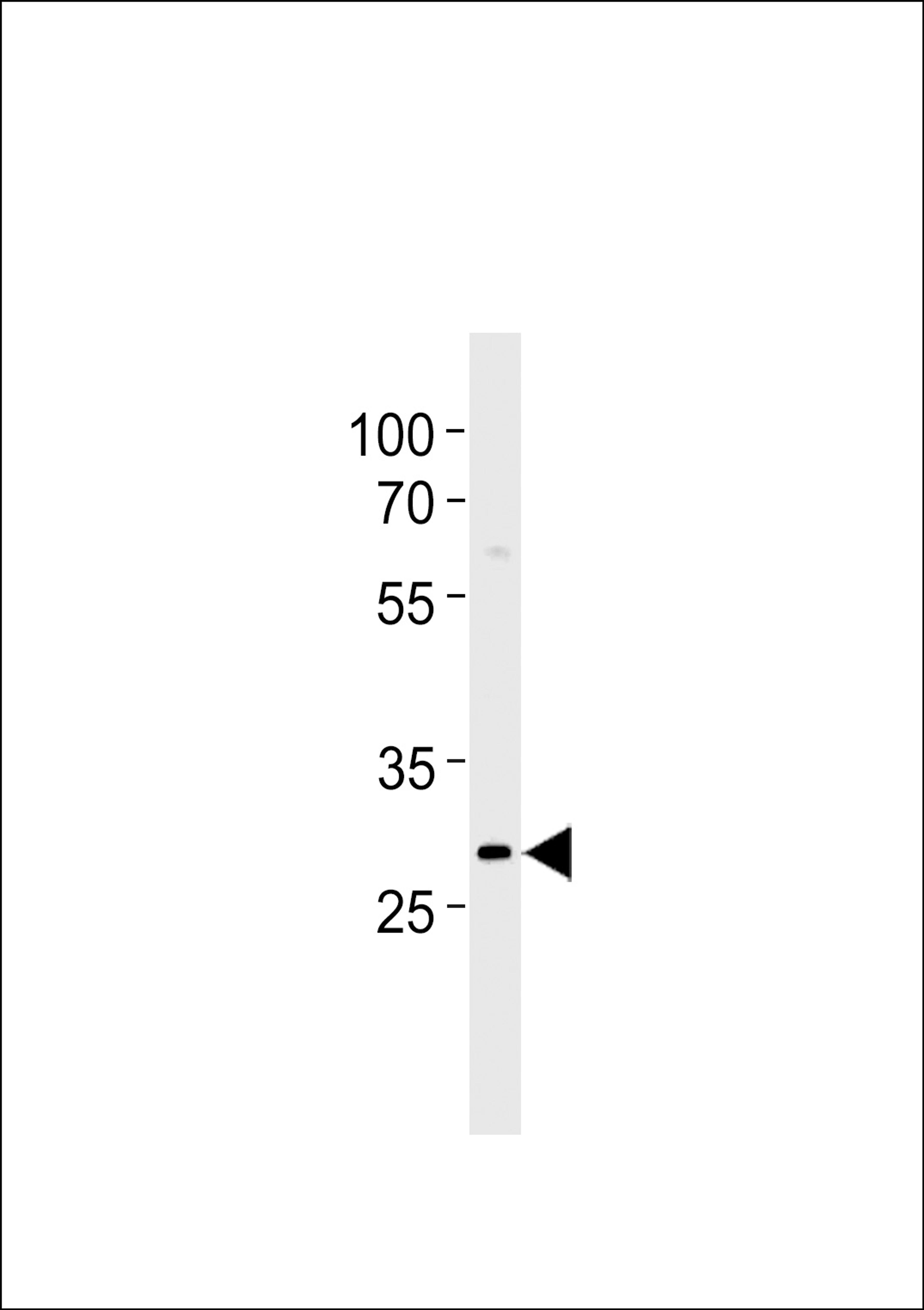 Western blot analysis in Daudi cell line lysates (35ug/lane).