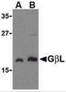 Western blot analysis of GbL in human brain cell lysate with GbL antibody at (A) 1 and (B) 2 &#956;g/mL.