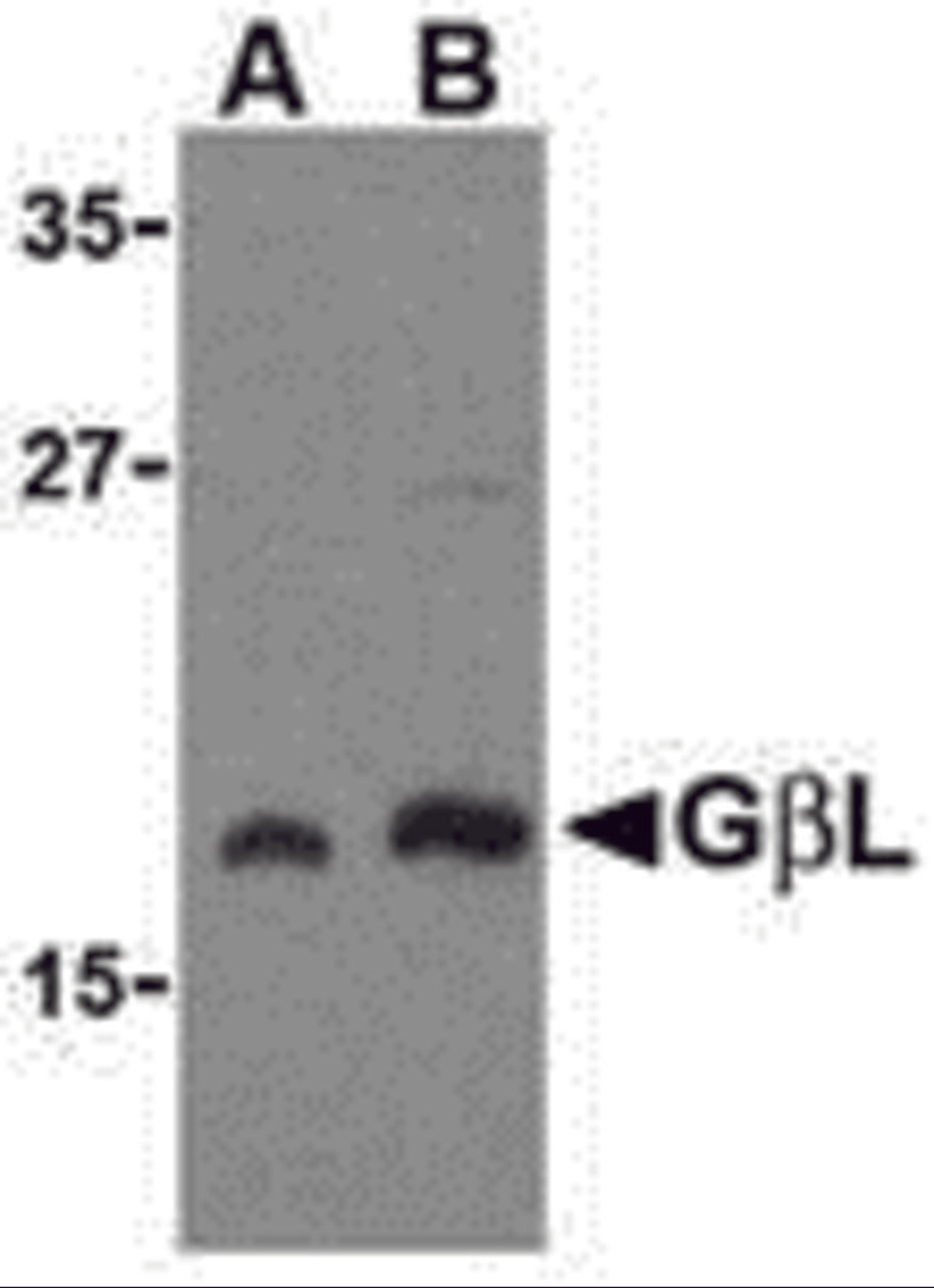 Western blot analysis of GbL in human brain cell lysate with GbL antibody at (A) 1 and (B) 2 &#956;g/mL.