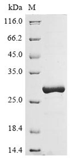 (Tris-Glycine gel) Discontinuous SDS-PAGE (reduced) with 5% enrichment gel and 15% separation gel.