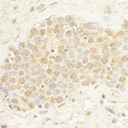 Detection of human WDR20 by immunohistochemistry.