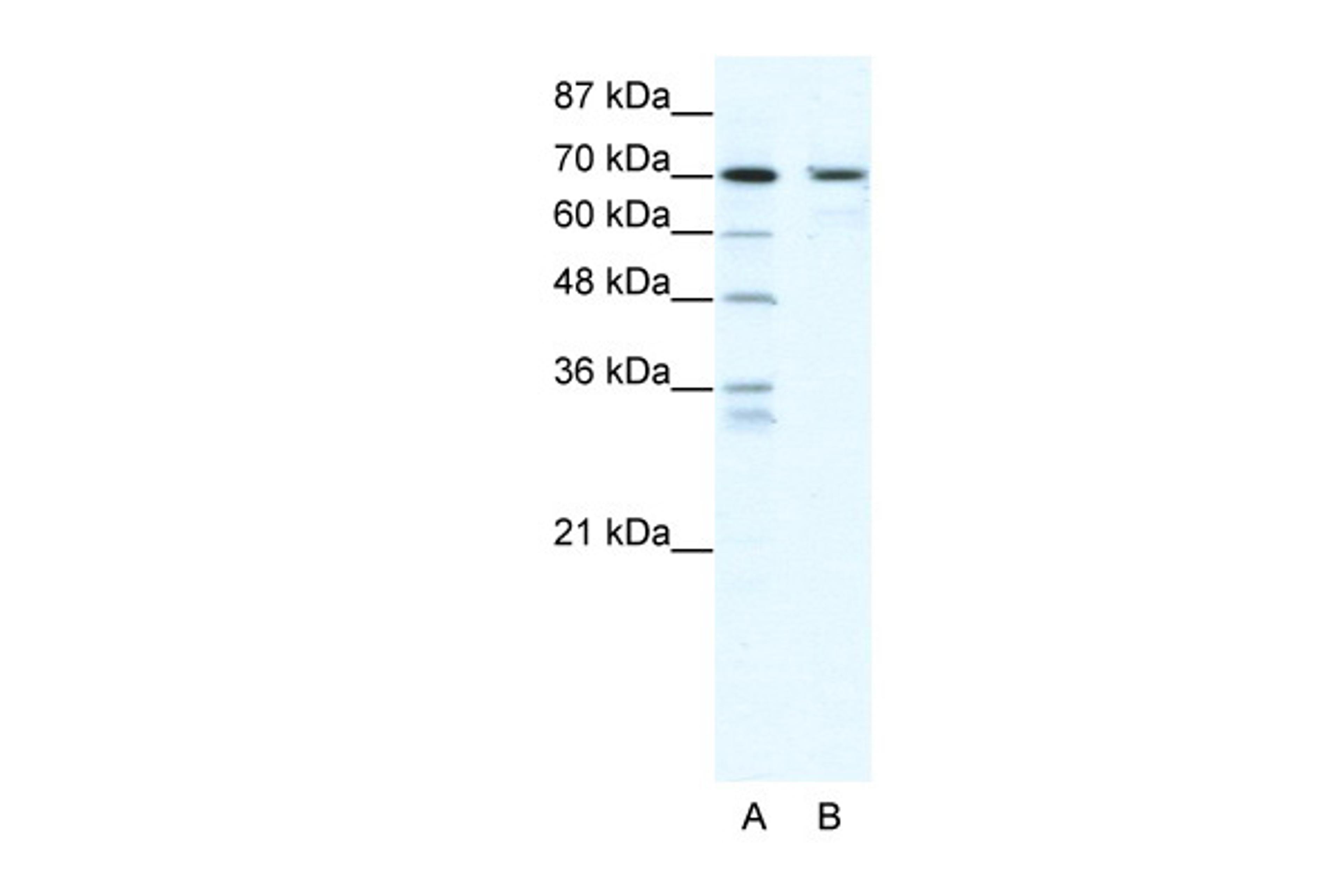 Antibody used in WB on Human HepG2 at 2.5 ug/ml.