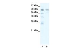 Antibody used in WB on Human HepG2 at 2.5 ug/ml.