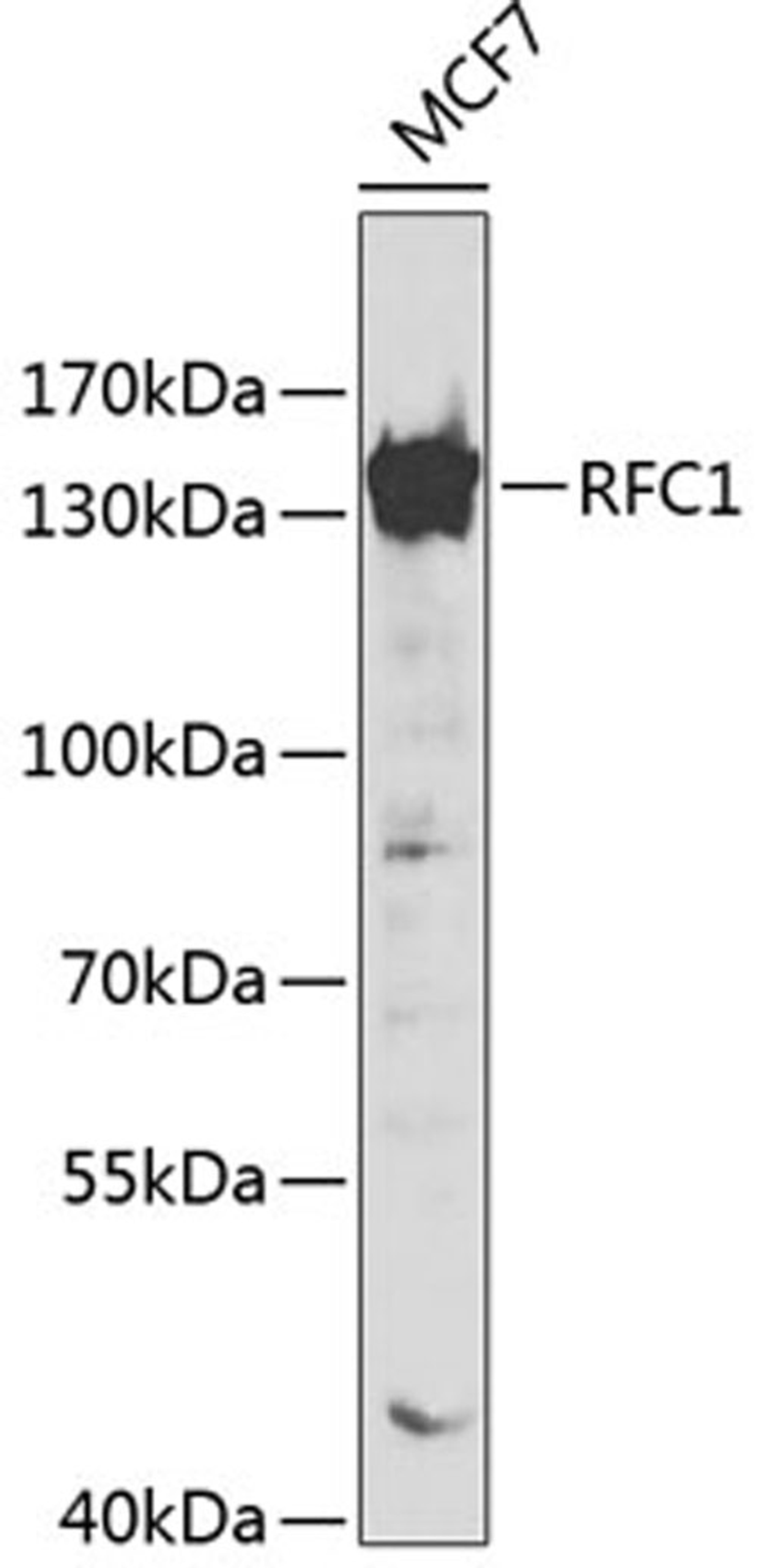 Western blot - RFC1 antibody (A1625)