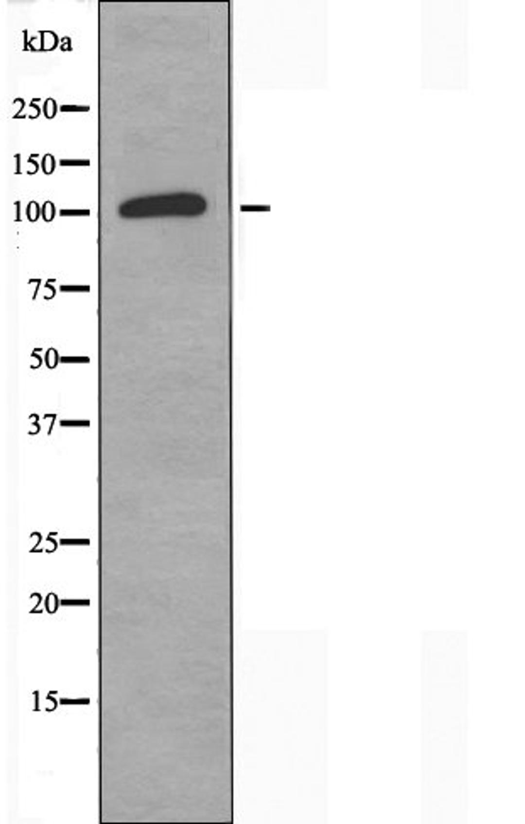 Western blot analysis of 293 cells using TOP3A antibody