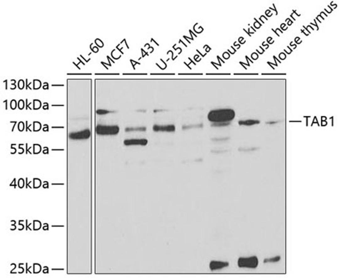 Western blot - TAB1 antibody (A5749)