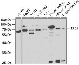 Western blot - TAB1 antibody (A5749)