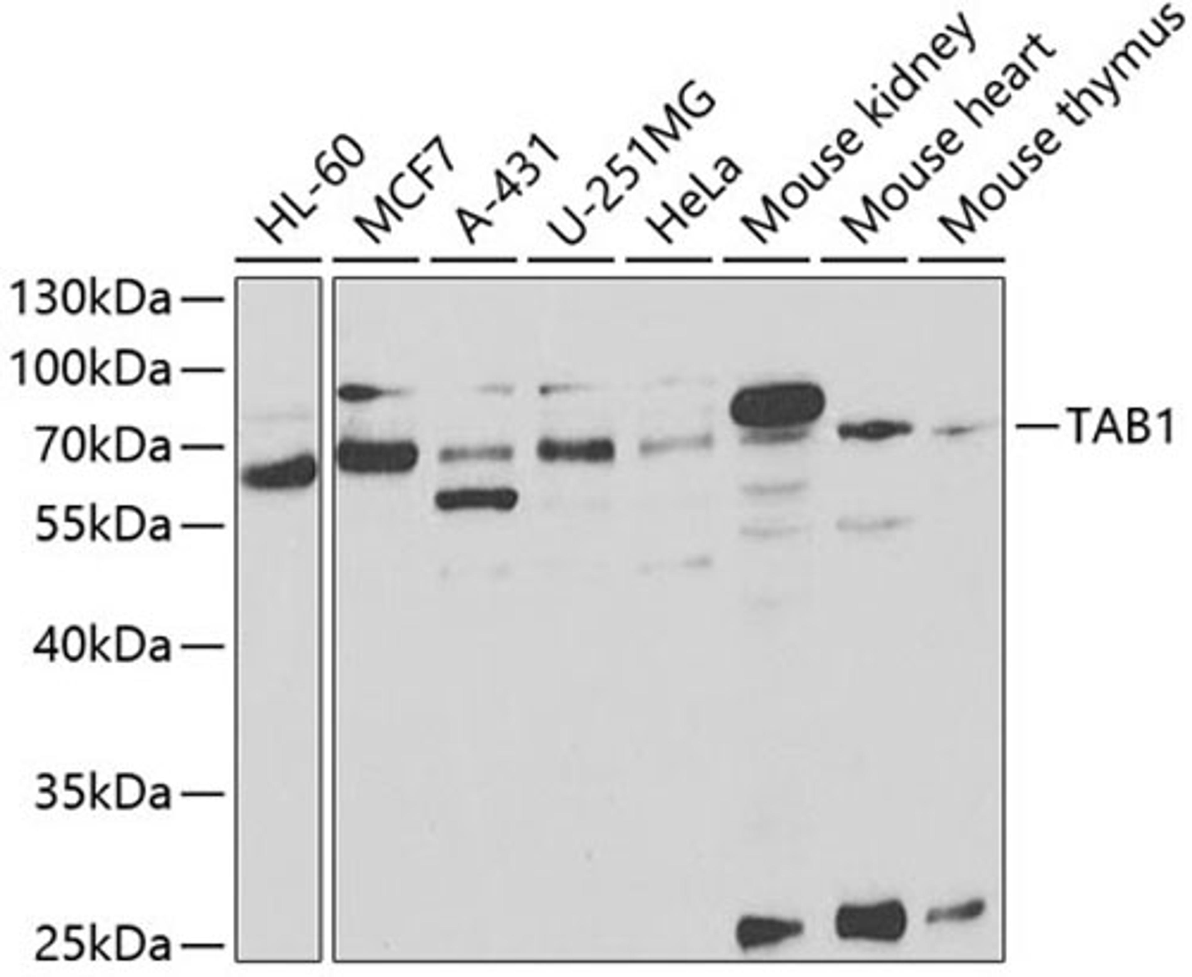 Western blot - TAB1 antibody (A5749)