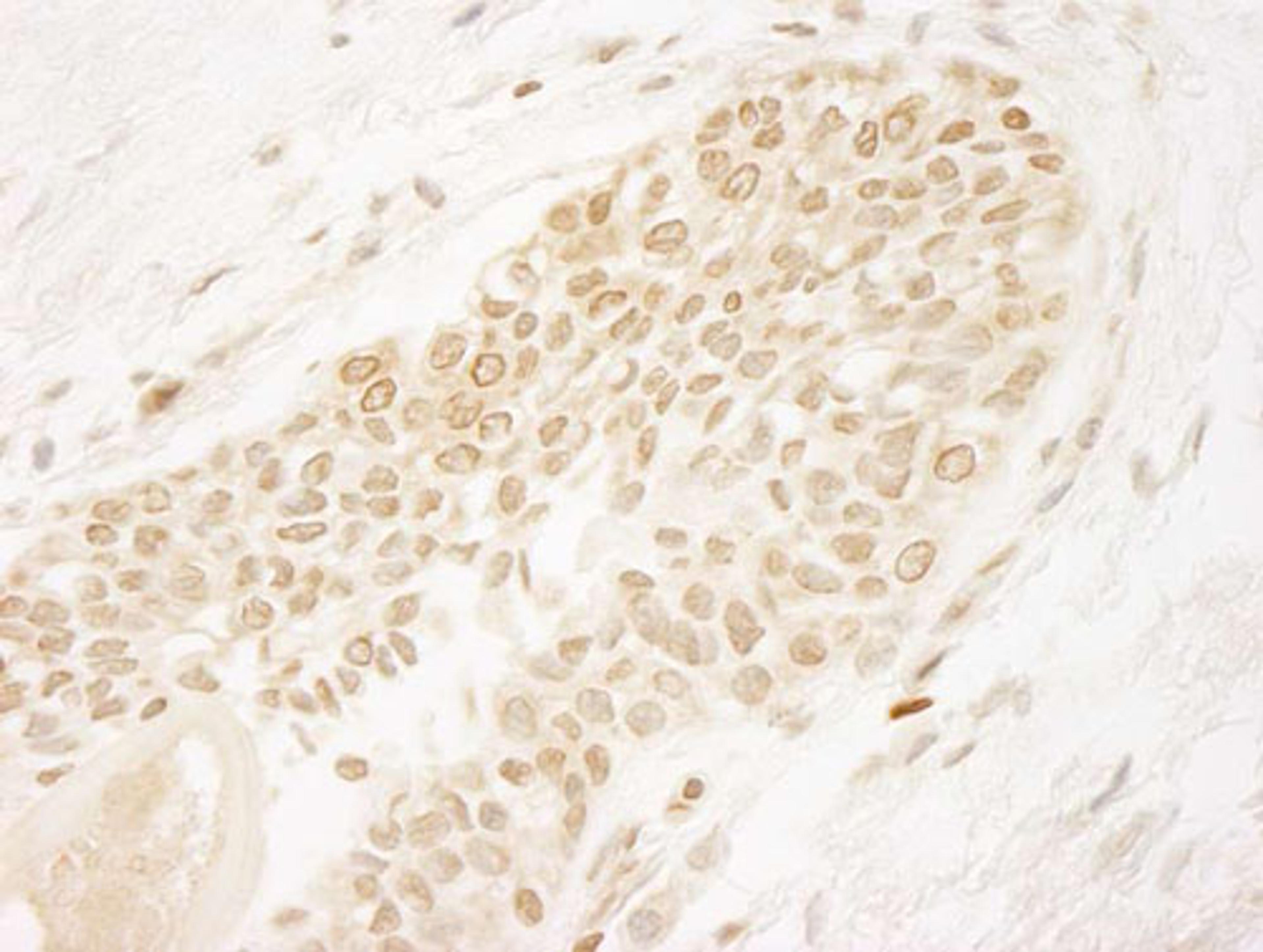 Detection of human PPP5C by IHC.