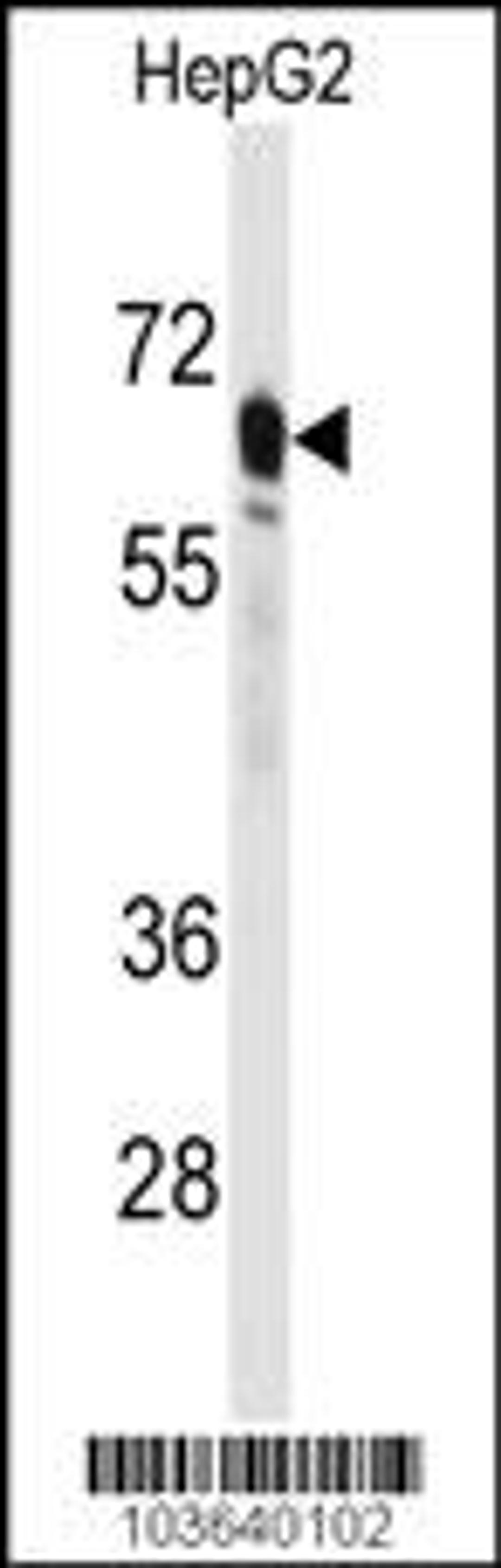 Western blot analysis of anti-PCK2 Antibody in HepG2 cell line lysates (35ug/lane)