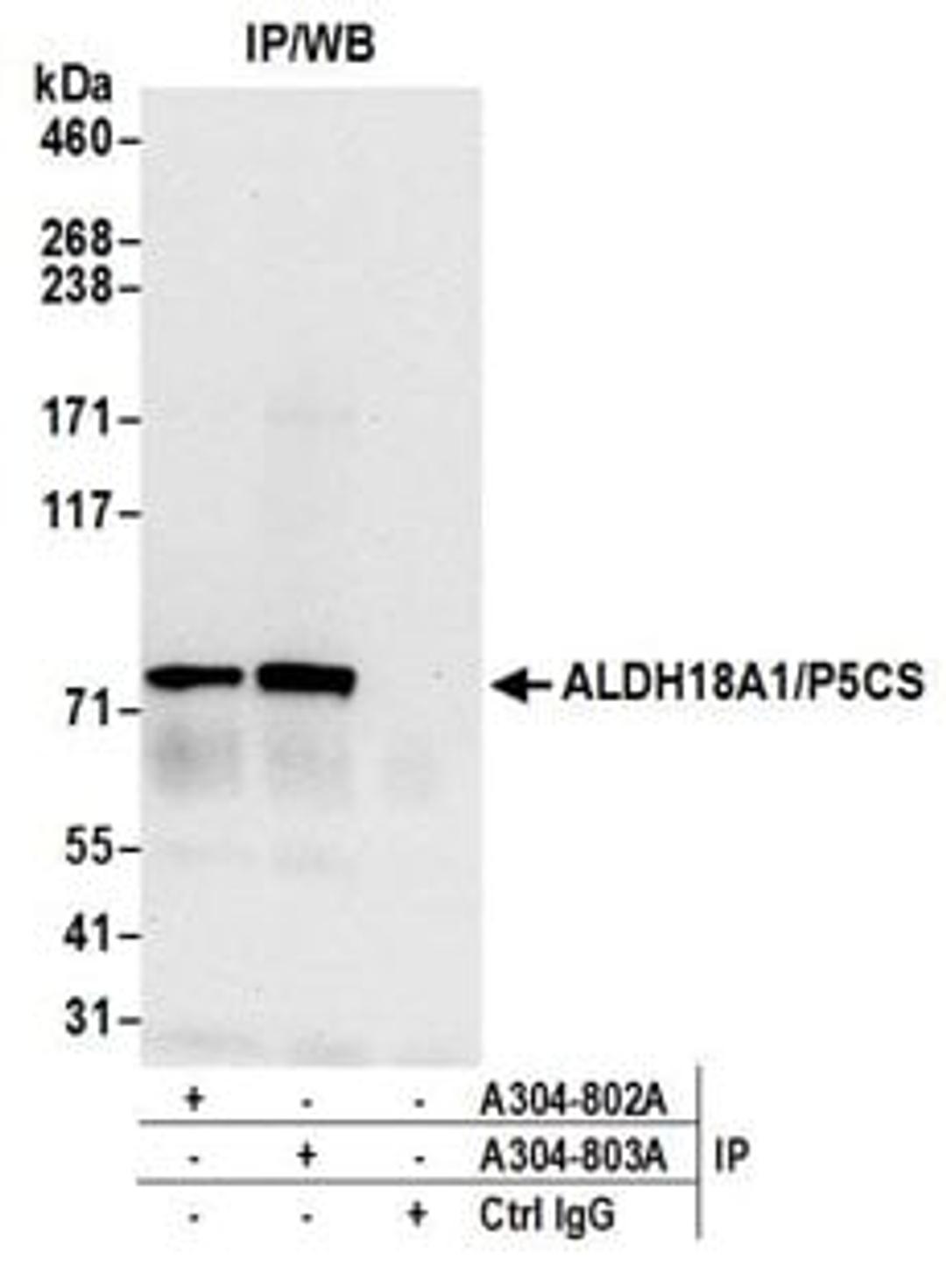 Detection of human ALDH18A1/P5CS by western blot of immunoprecipitates.