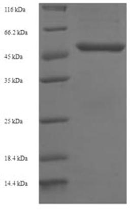 (Tris-Glycine gel) Discontinuous SDS-PAGE (reduced) with 5% enrichment gel and 15% separation gel.