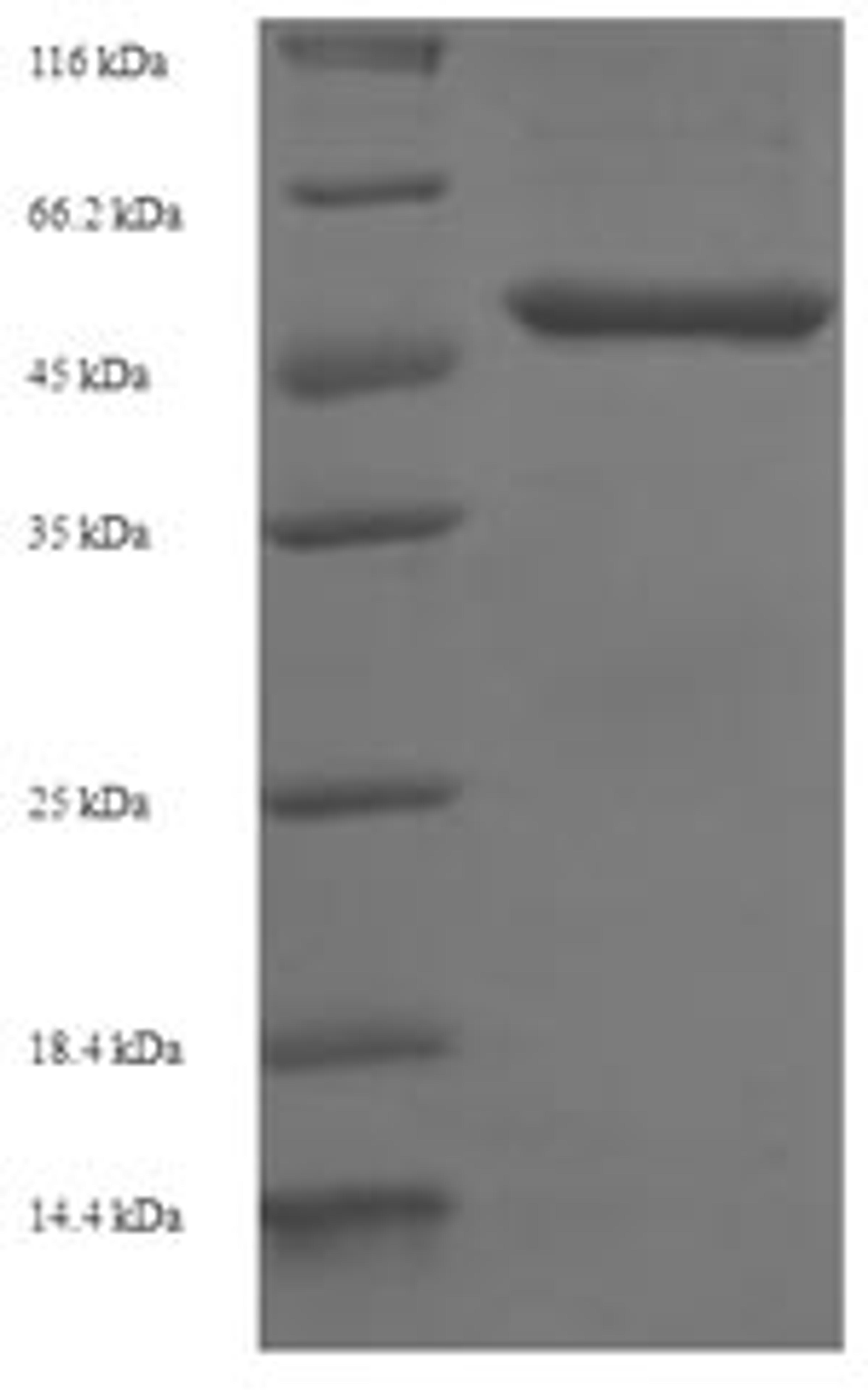 (Tris-Glycine gel) Discontinuous SDS-PAGE (reduced) with 5% enrichment gel and 15% separation gel.