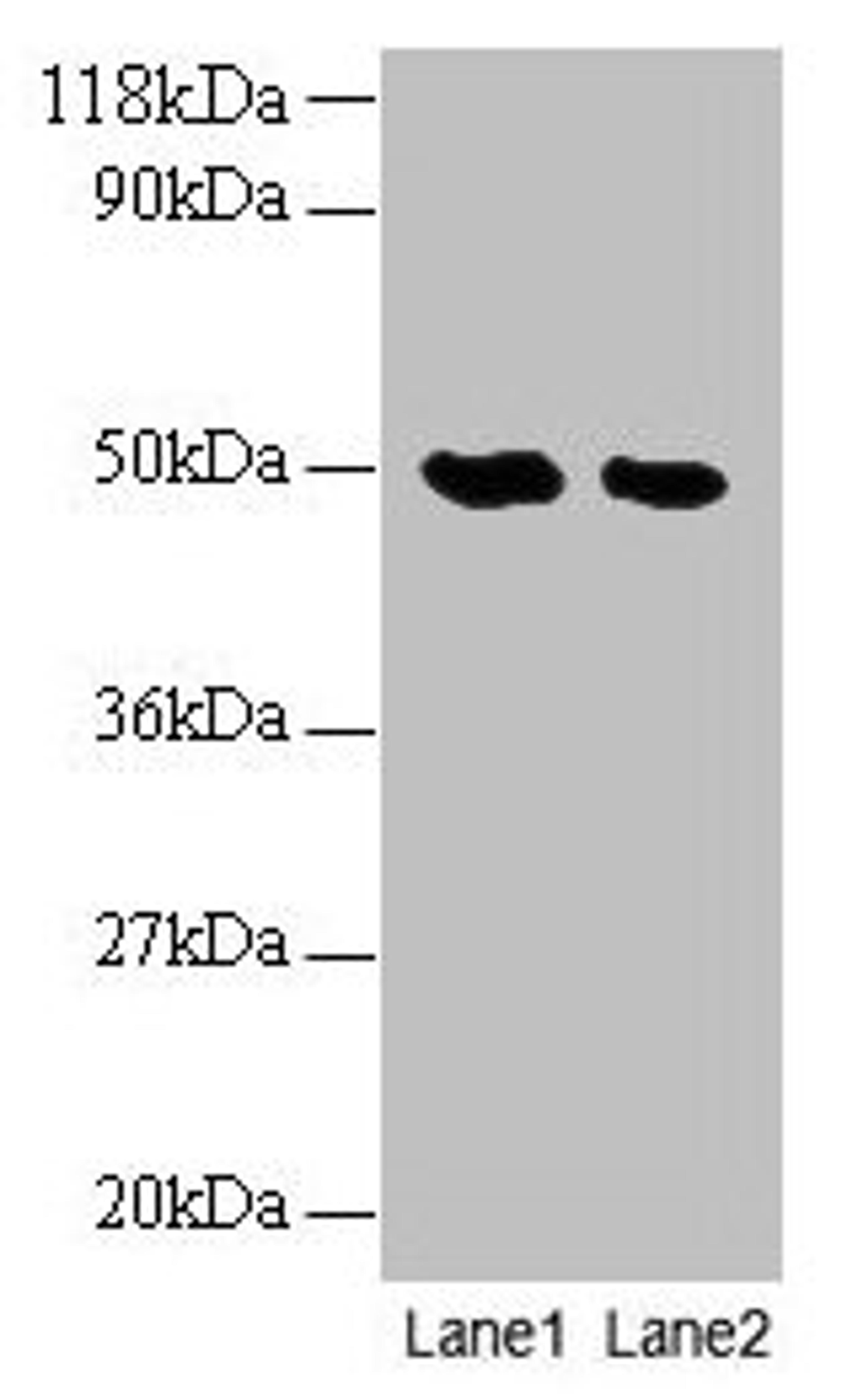 Western blot. All lanes: LCAT antibody at 2µg/ml. Lane 1: EC109 whole cell lysate. Lane 2: 293T whole cell lysate. Secondary. Goat polyclonal to rabbit IgG at 1/10000 dilution. Predicted band size: 50 kDa. Observed band size: 50 kDa