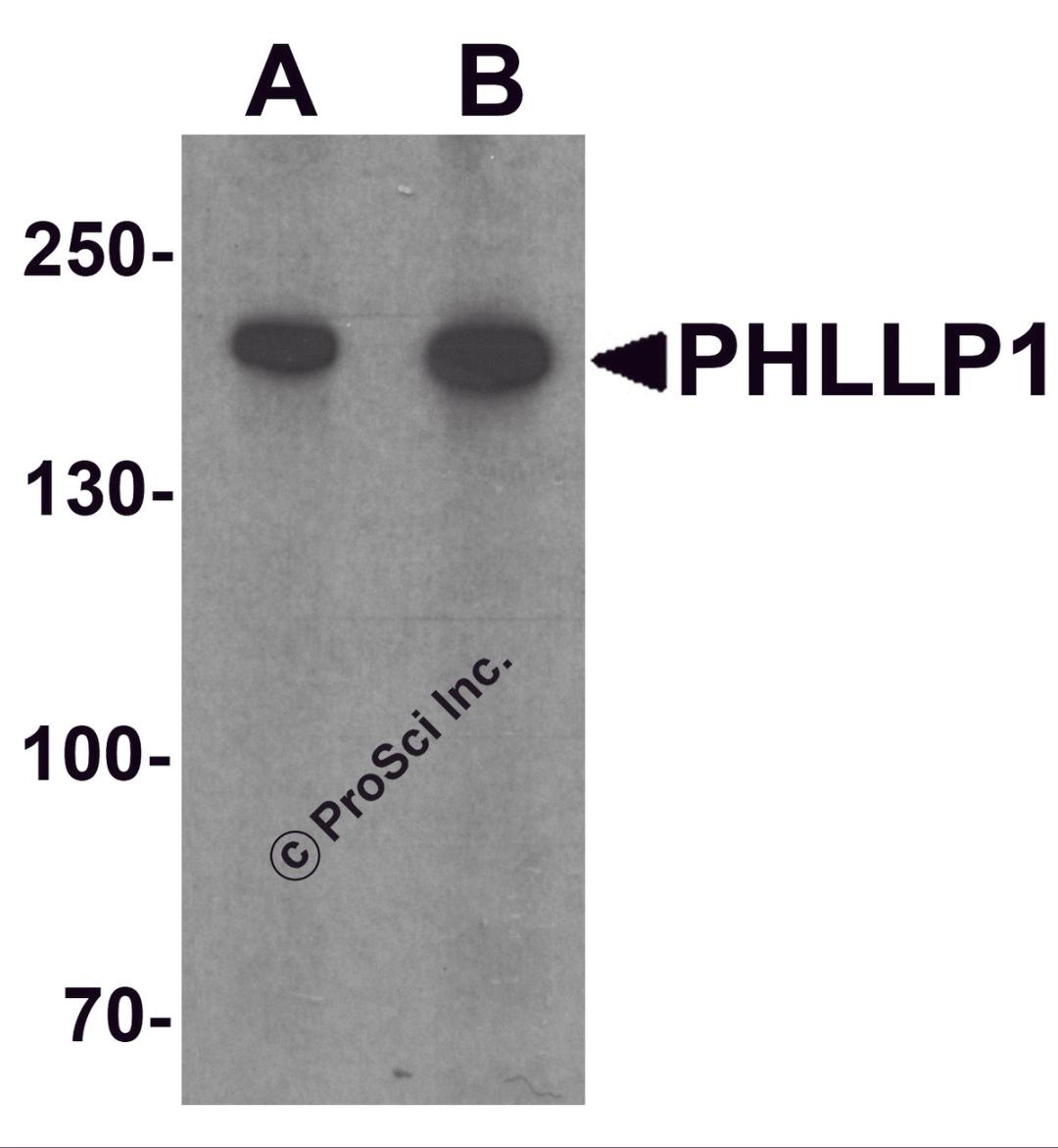 Western blot analysis of PHLPP1 in SW480 cell lysate with PHLPP1 antibody at (A) 1 and (B) 2 &#956;g/mL.