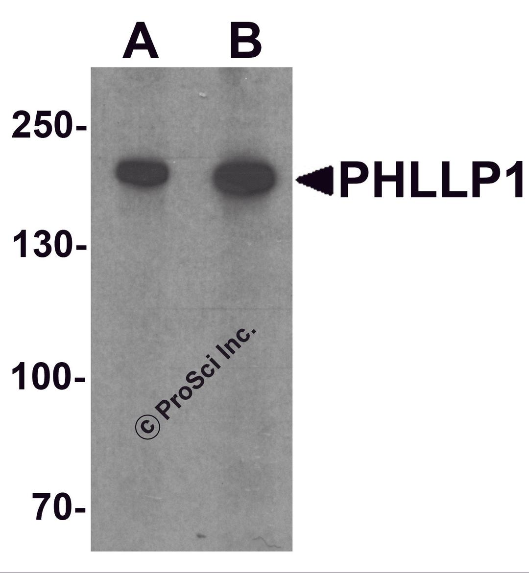 Western blot analysis of PHLPP1 in SW480 cell lysate with PHLPP1 antibody at (A) 1 and (B) 2 μg/mL.