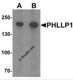 Western blot analysis of PHLPP1 in SW480 cell lysate with PHLPP1 antibody at (A) 1 and (B) 2 μg/mL.