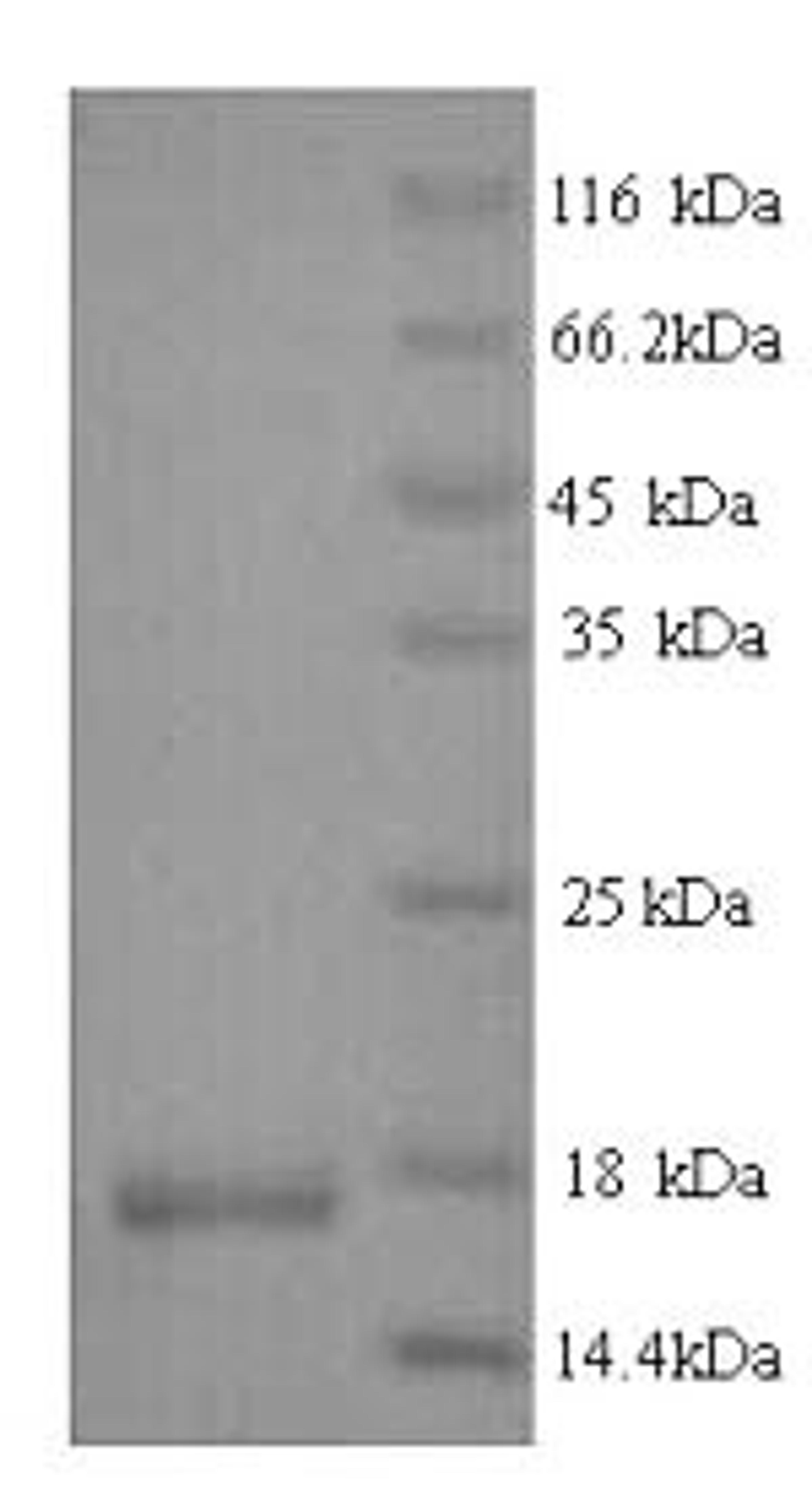 (Tris-Glycine gel) Discontinuous SDS-PAGE (reduced) with 5% enrichment gel and 15% separation gel.