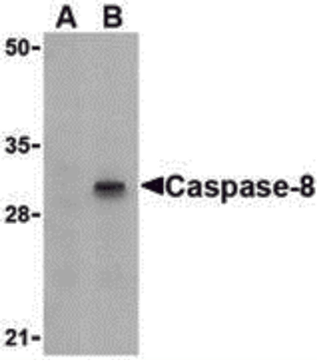 Western blot analysis of Caspase-8 in HT-29 cell lysate with Caspase-8 antibody (IN) at 1 μg/mL in (A) the presence or (B) the absence of blocking peptide.