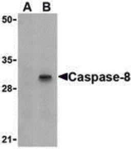 Western blot analysis of Caspase-8 in HT-29 cell lysate with Caspase-8 antibody (IN) at 1 μg/mL in (A) the presence or (B) the absence of blocking peptide.