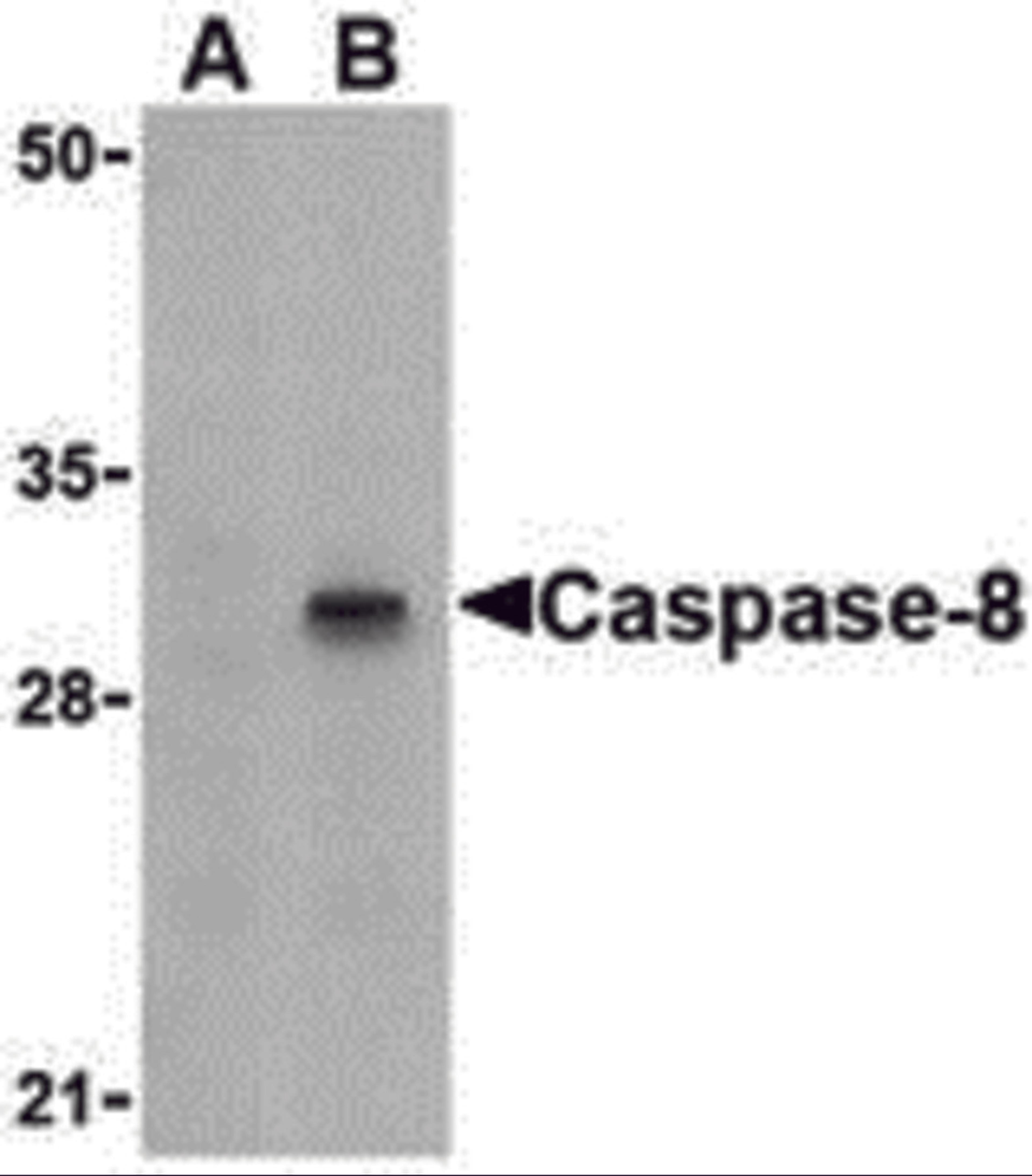 Western blot analysis of Caspase-8 in HT-29 cell lysate with Caspase-8 antibody (IN) at 1 μg/mL in (A) the presence or (B) the absence of blocking peptide.