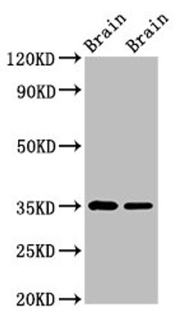 Western Blot. Positive WB detected in: Rat brain tissue, Mouse brain tissue. All lanes: Egln3 antibody at 3.6µg/ml. Secondary. Goat polyclonal to rabbit IgG at 1/50000 dilution. Predicted band size: 28 kDa. Observed band size: 35 kDa