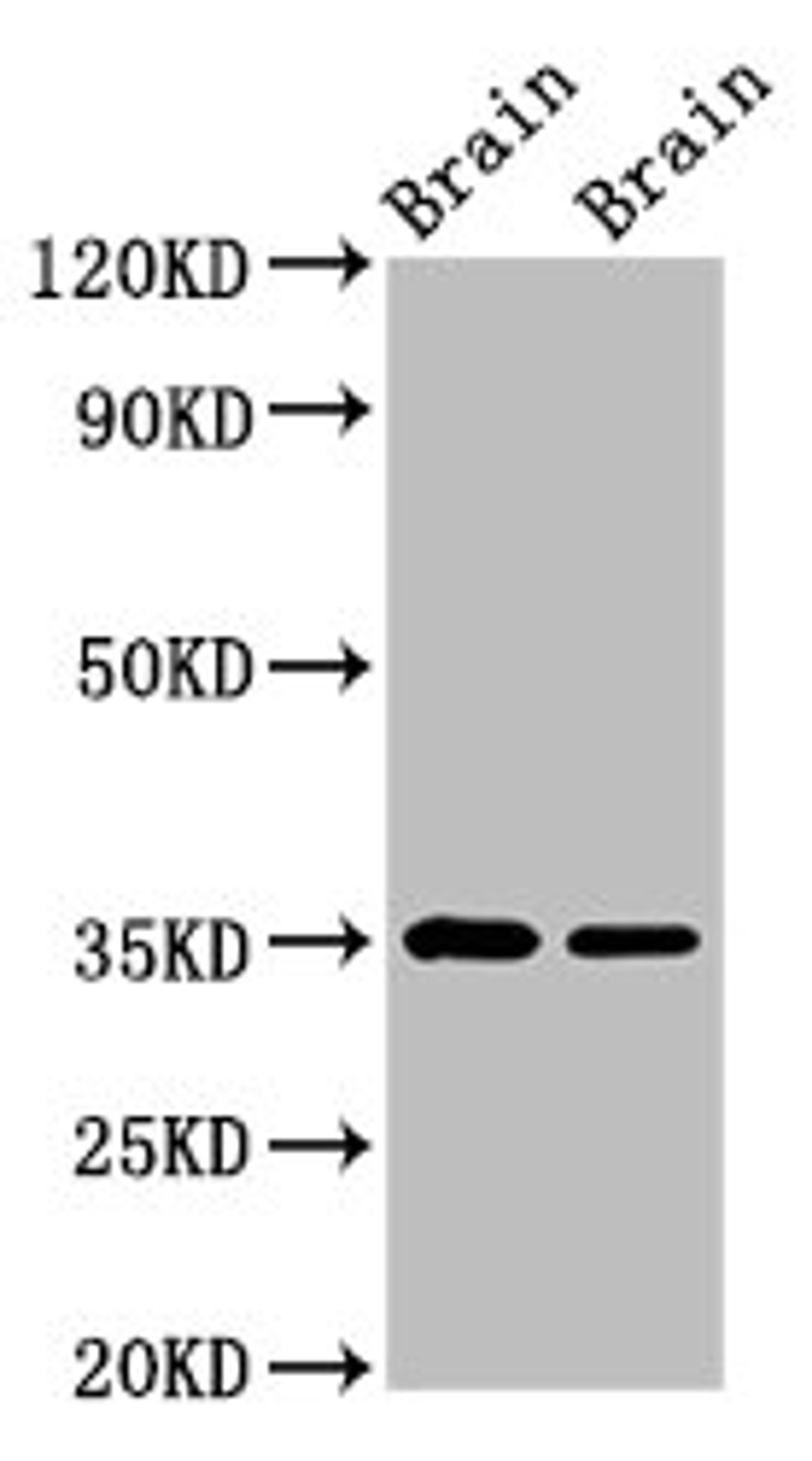 Western Blot. Positive WB detected in: Rat brain tissue, Mouse brain tissue. All lanes: Egln3 antibody at 3.6µg/ml. Secondary. Goat polyclonal to rabbit IgG at 1/50000 dilution. Predicted band size: 28 kDa. Observed band size: 35 kDa