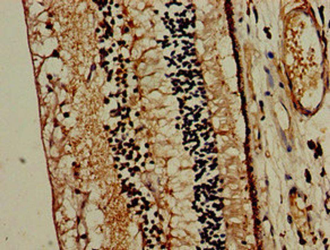 Immunohistochemistry of paraffin-embedded human eye tissue using CSB-PA015190LA01HU at dilution of 1:100