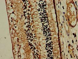 Immunohistochemistry of paraffin-embedded human eye tissue using CSB-PA015190LA01HU at dilution of 1:100