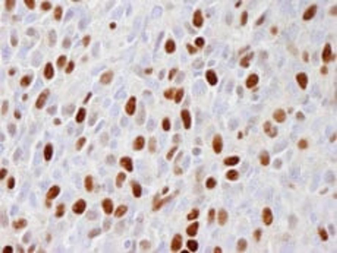 Detection of mouse phospho-MCM2 (Ser 108) by immunohistochemistry.