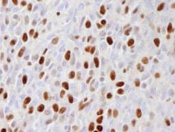 Detection of mouse phospho-MCM2 (Ser 108) by immunohistochemistry.